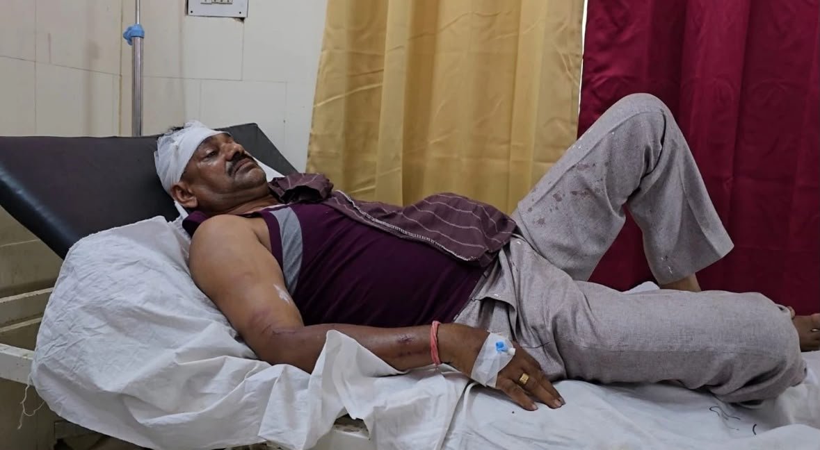 यूपी के कौशांबी में छत्तीसगढ़ पुलिस टीम पर हमला, आरक्षक का हाथ टूटा 1 IMG 20260607 WA0003