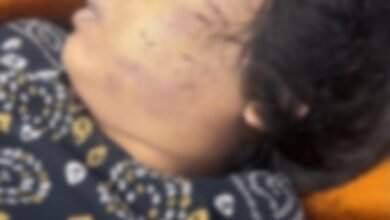 लिव-इन में रह रही बीएड छात्रा की संदिग्ध मौत, बहन का आरोप- पार्टनर ने मारपीट के बाद की हत्या 4 IMG 20260806 WA00071