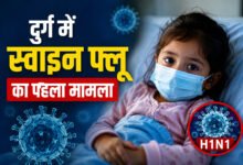 दुर्ग की 2 साल 11 माह की बच्ची में H1N1 की पुष्टि 8 file 00000000630881fa85ef743d42a72207
