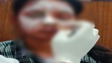 बालोद में लव प्रपोजल ठुकराने पर छात्रा पर एसिड अटैक के मामले में दो युवक हिरासत में,हेड कॉन्स्टेबल की बेटी को बनाया निशाना 1 IMG 20261006 124828