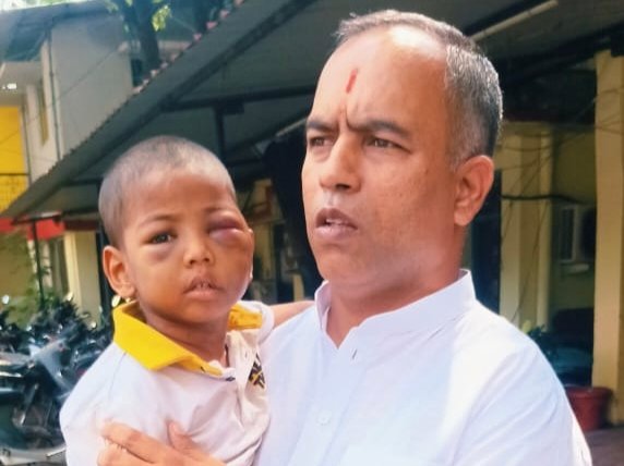 घायल मासूम के लिए फरिश्ता बनकर पहुंचे थे राहुल हरितवाल, सूचना मिलते ही अस्पताल पहुंचाया; पुलिस को सूचना देकर आरोपी सौतेला पिता और मां और कराया गिरफ्तार 1 IMG 20261018 220025